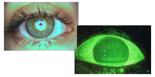 C.Diag Eye examinations
