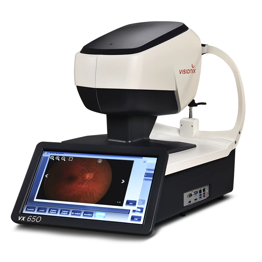 VX650 Ophthalmic Analyzer